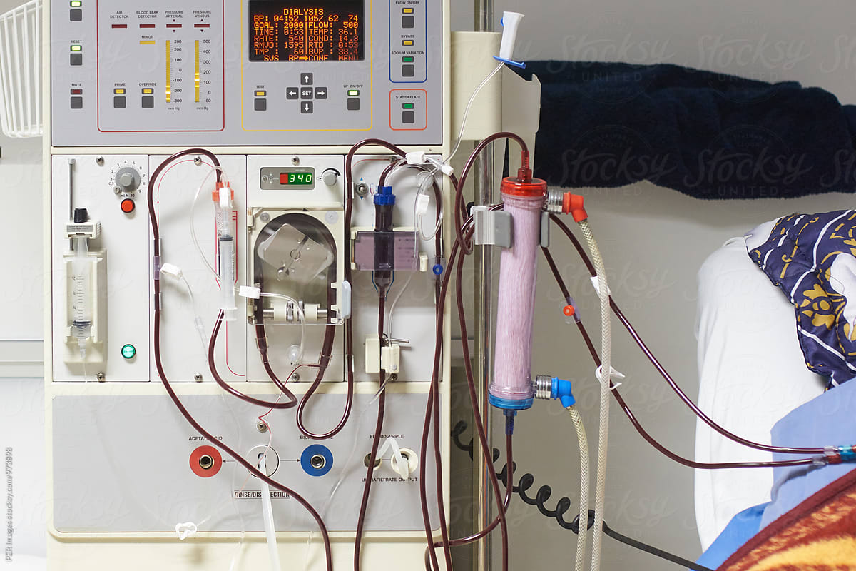 new-hemodialysis-machine-to-deal-with-kidney-issues-the-islandsun